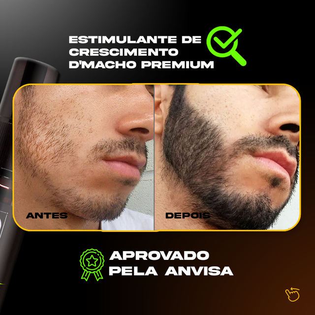 ESTIMULANTE REDENSYL 30ML DMACHO