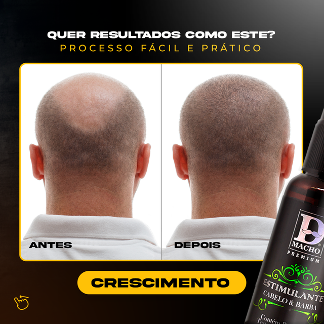 ESTIMULANTE REDENSYL 30ML DMACHO